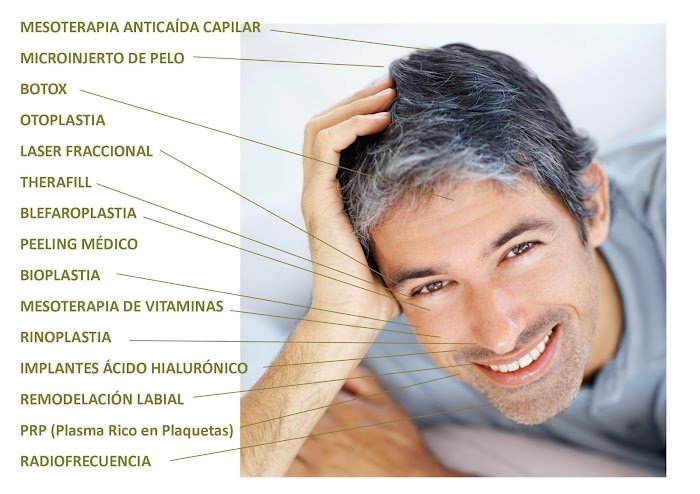 Imagen del Slider