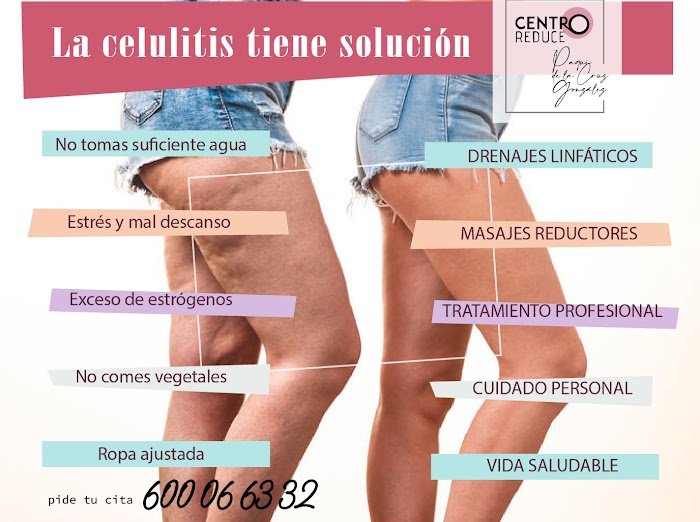 Imagen del Slider