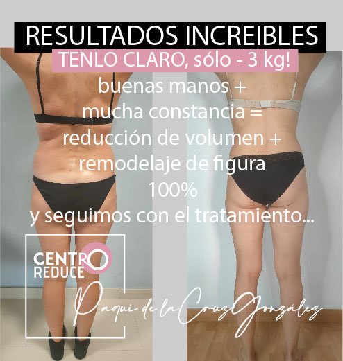 Imagen del Slider