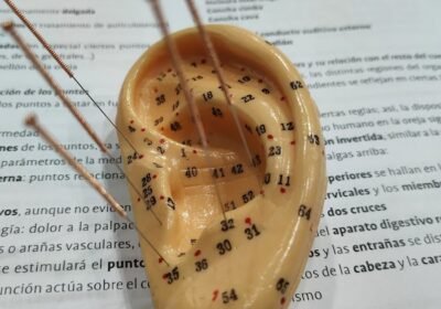 Acupuntura y Medicina Tradicional China – Maritza C. Novella Koo