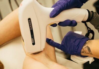Depilación Laser y Eliminación Tatuajes Estepona – Divinity Beauty Center