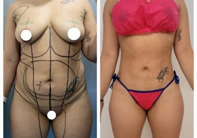 Estética integral CORPO BELLA