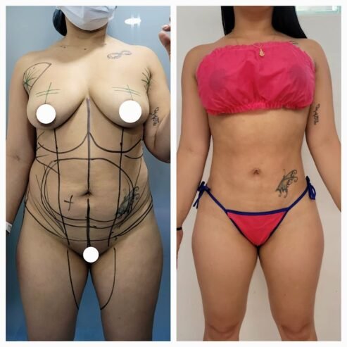 Estética integral CORPO BELLA