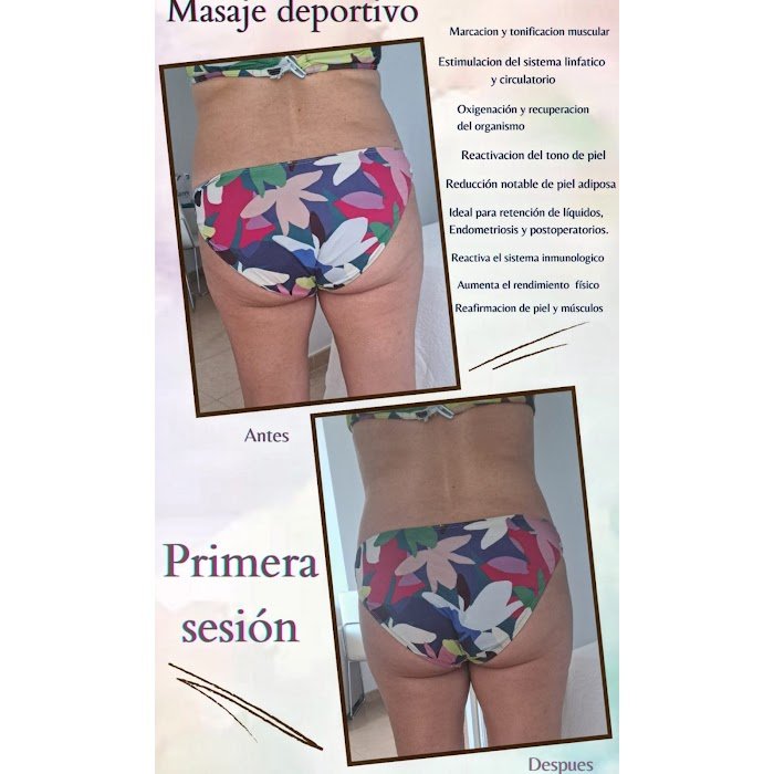 Imagen del Slider