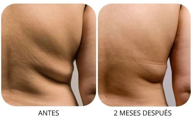 Imagen del Slider