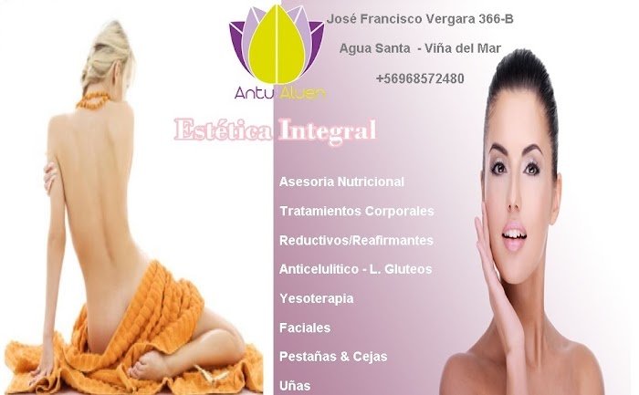 Imagen del Slider