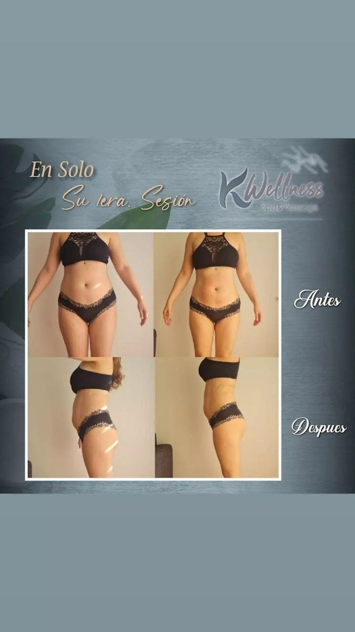 Imagen del Slider