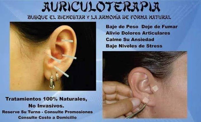 Imagen del Slider