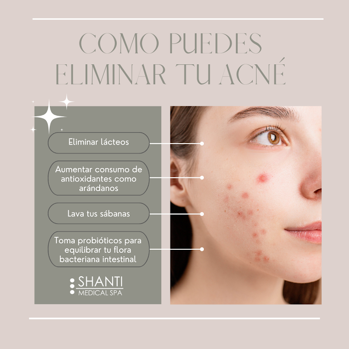 Imagen del Slider