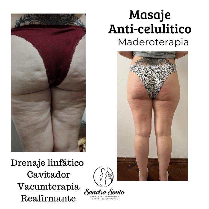 Imagen del Slider