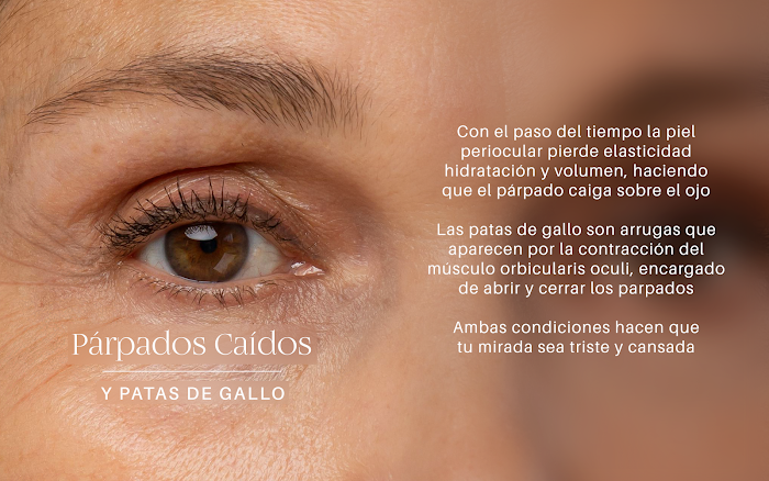 Imagen del Slider