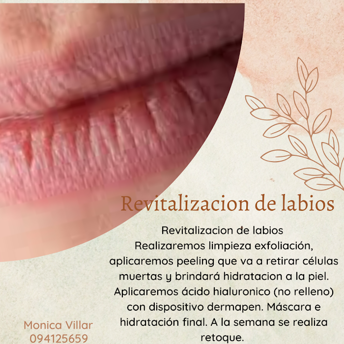 Imagen del Slider
