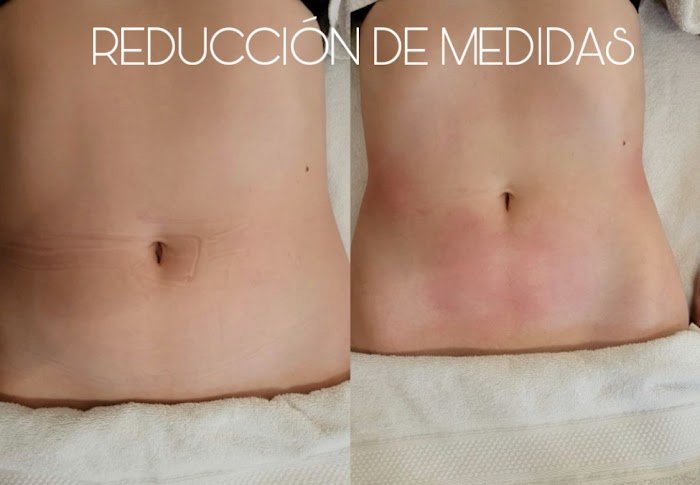 Imagen del Slider
