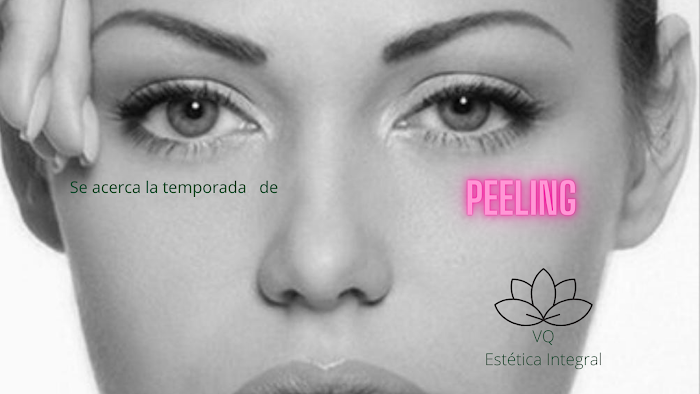 Imagen del Slider