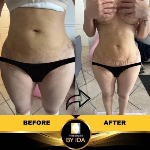 Lymphatic Relaxing Special By Ida