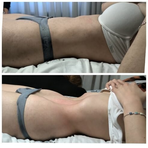 MASAJES POST OPERATORIOS