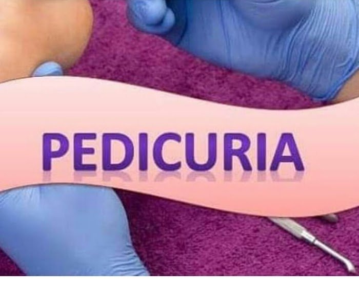 Imagen del Slider