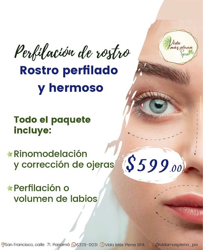 Imagen del Slider