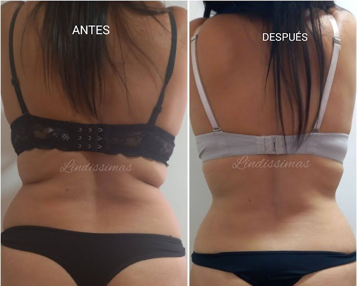 Imagen del Slider