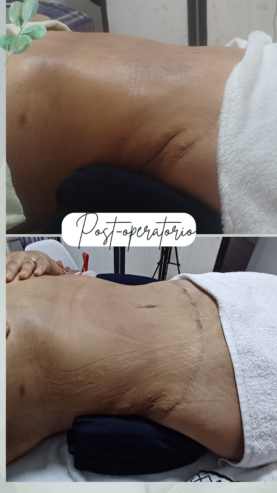 Myka spa