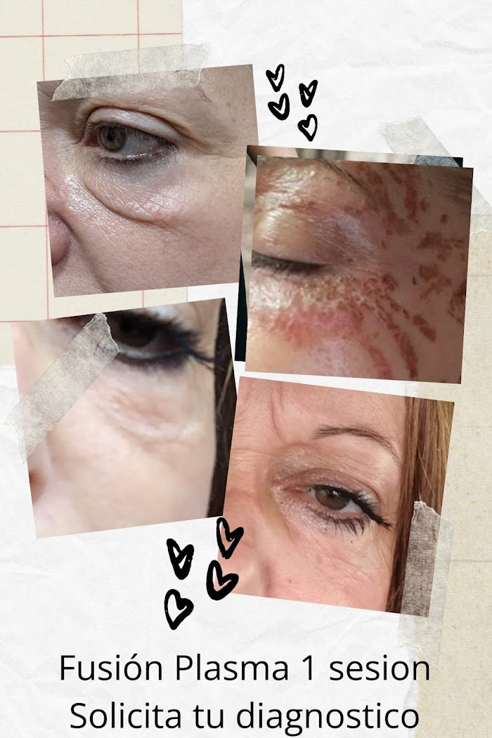 1745829401 531 Carla Alvarez Estetica Avanzada Carla Alvarez Estetica Avanzada